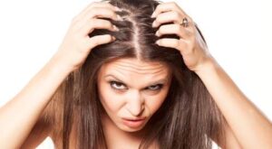 علاج الثعلبة نهائيا .. حلم أم حقيقة (تفاصيل هامة) الثعلبة البقعية