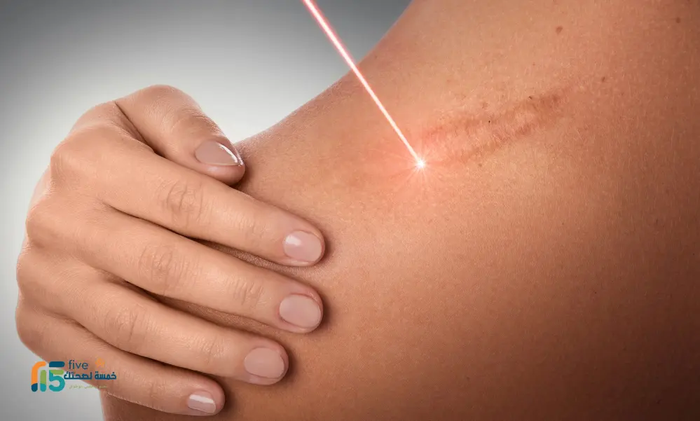 عملية تجميل الحروق: رحلة استعادة المظهر والثقة بالنفس عملية تجميل الحروق